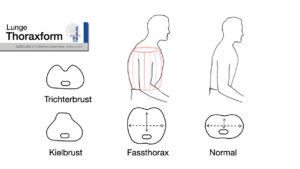 MODUL 4.1 Untersuchung Von Thorax Und Lunge – U-Kurs