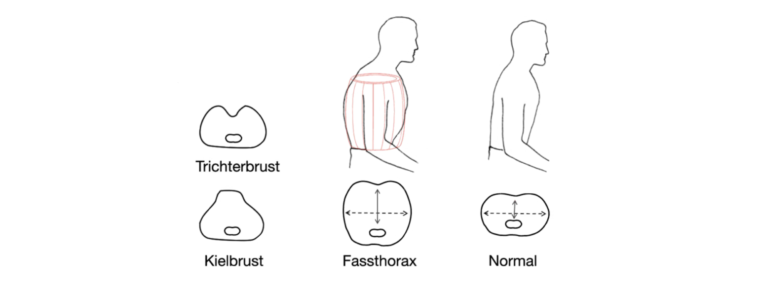 Modul Untersuchung Von Thorax Und Lunge U Kurs